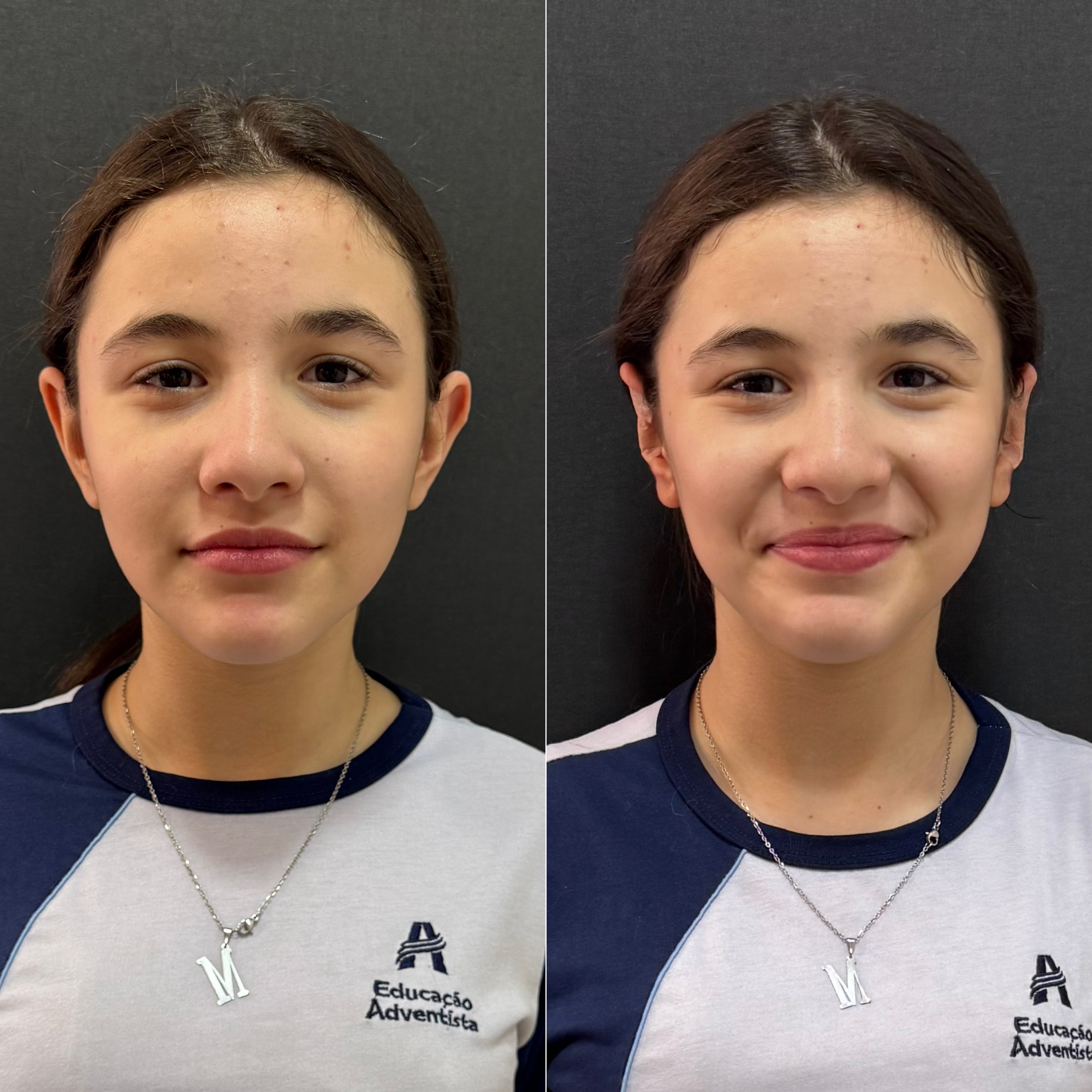 Resultado de Otomodelação — antes e depois
