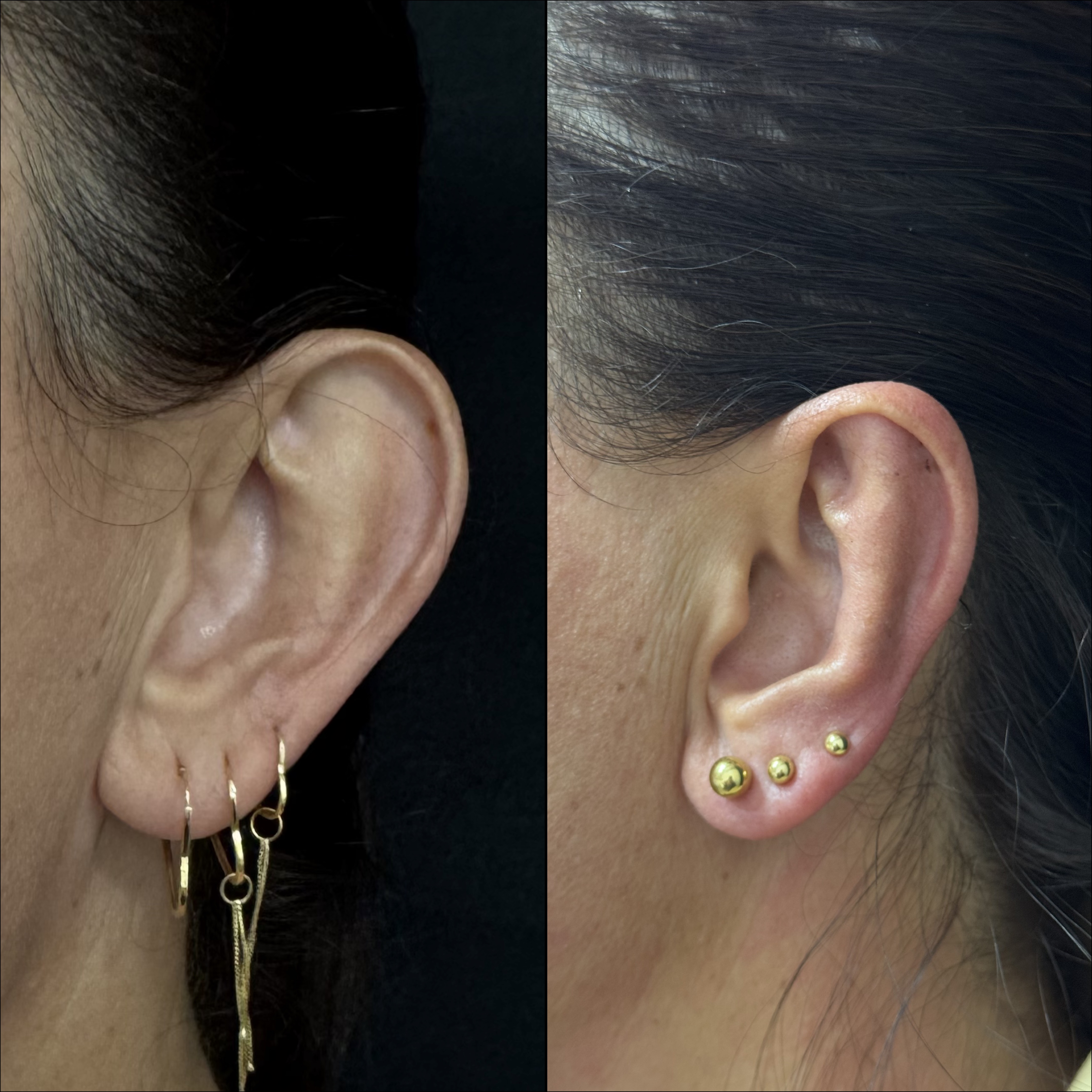 Resultado de Otomodelação — antes e depois